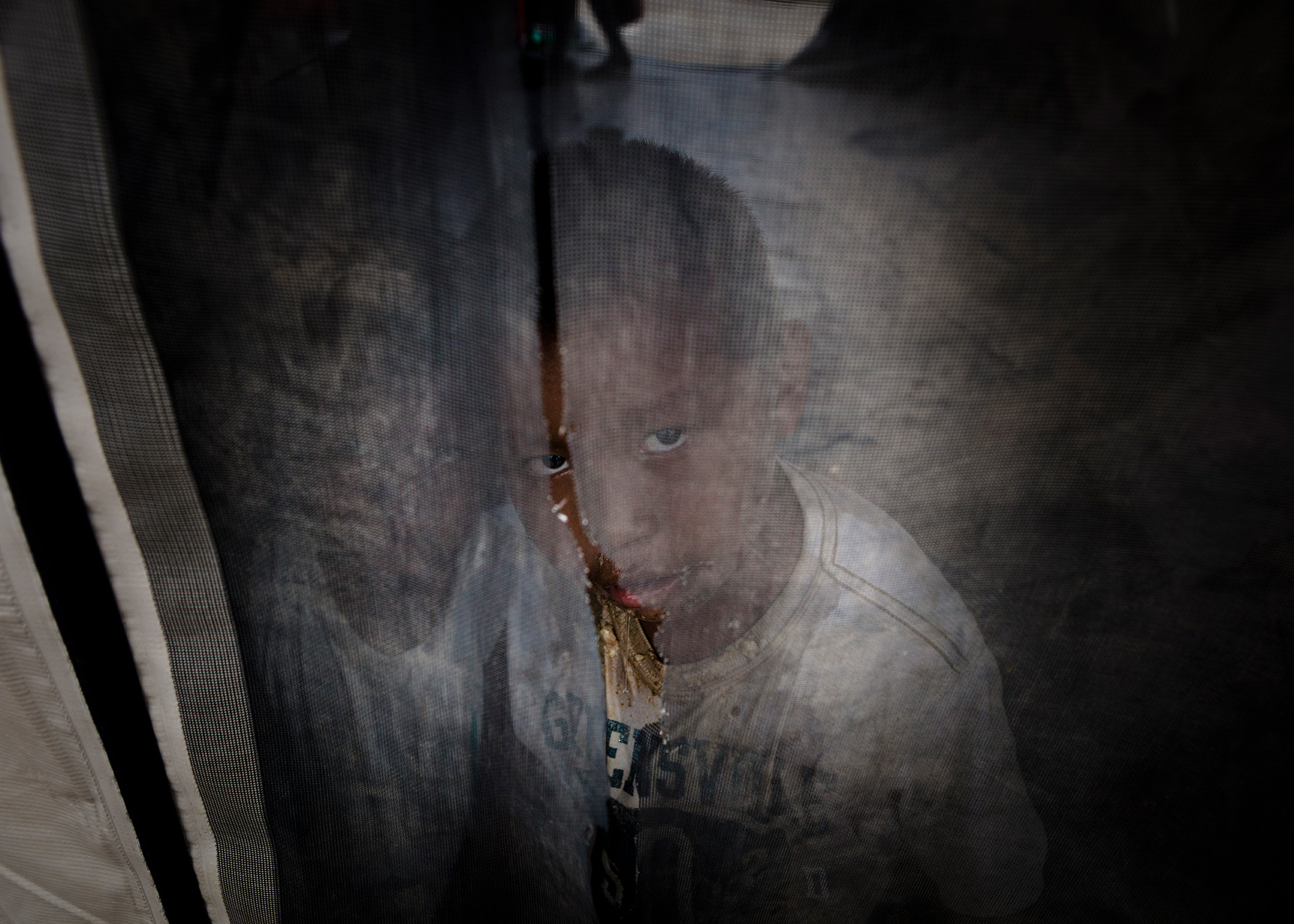 Due to measles, an indigenous Venezuelan boy is segregated at Pintolandia shelter, 2019.