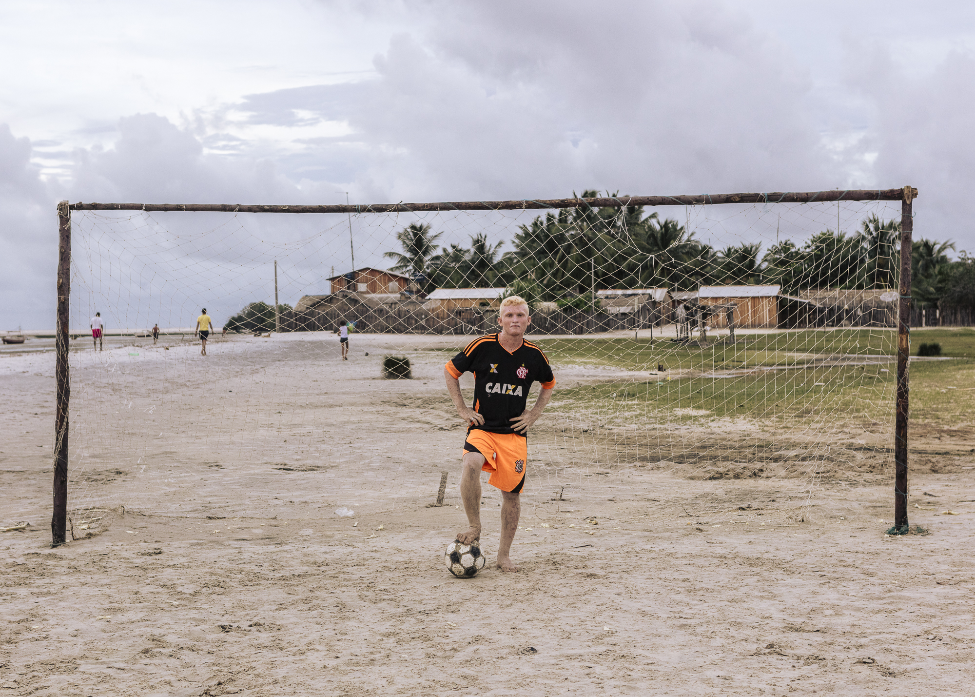 Due to the strong sun and the albinism, Sanã is only able to play soccer when the sun sets.