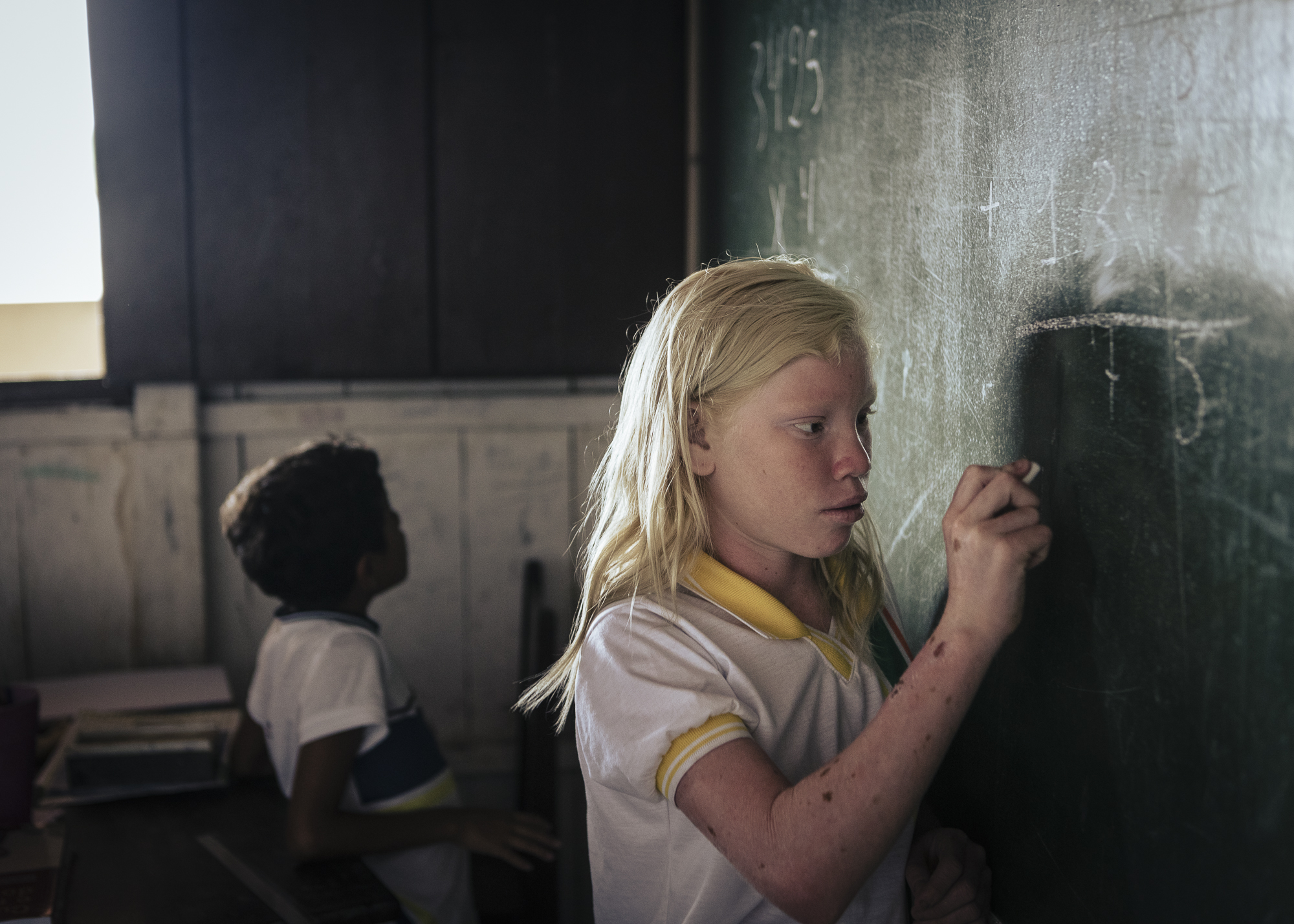 Portrait of Ana Raissa, the only of the last students with albinism in the local school.