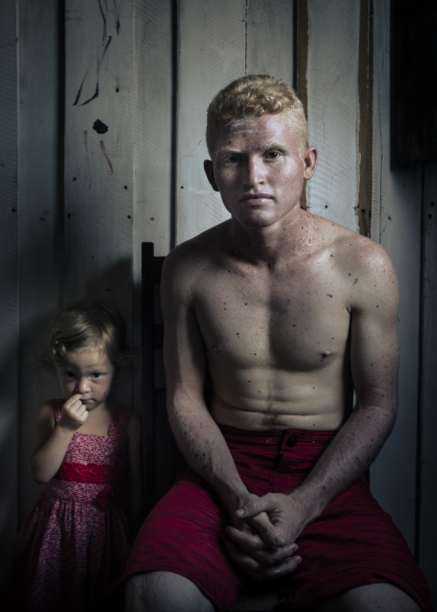 Portrait of Sana and his cousin Clara, both with the albinism condition.