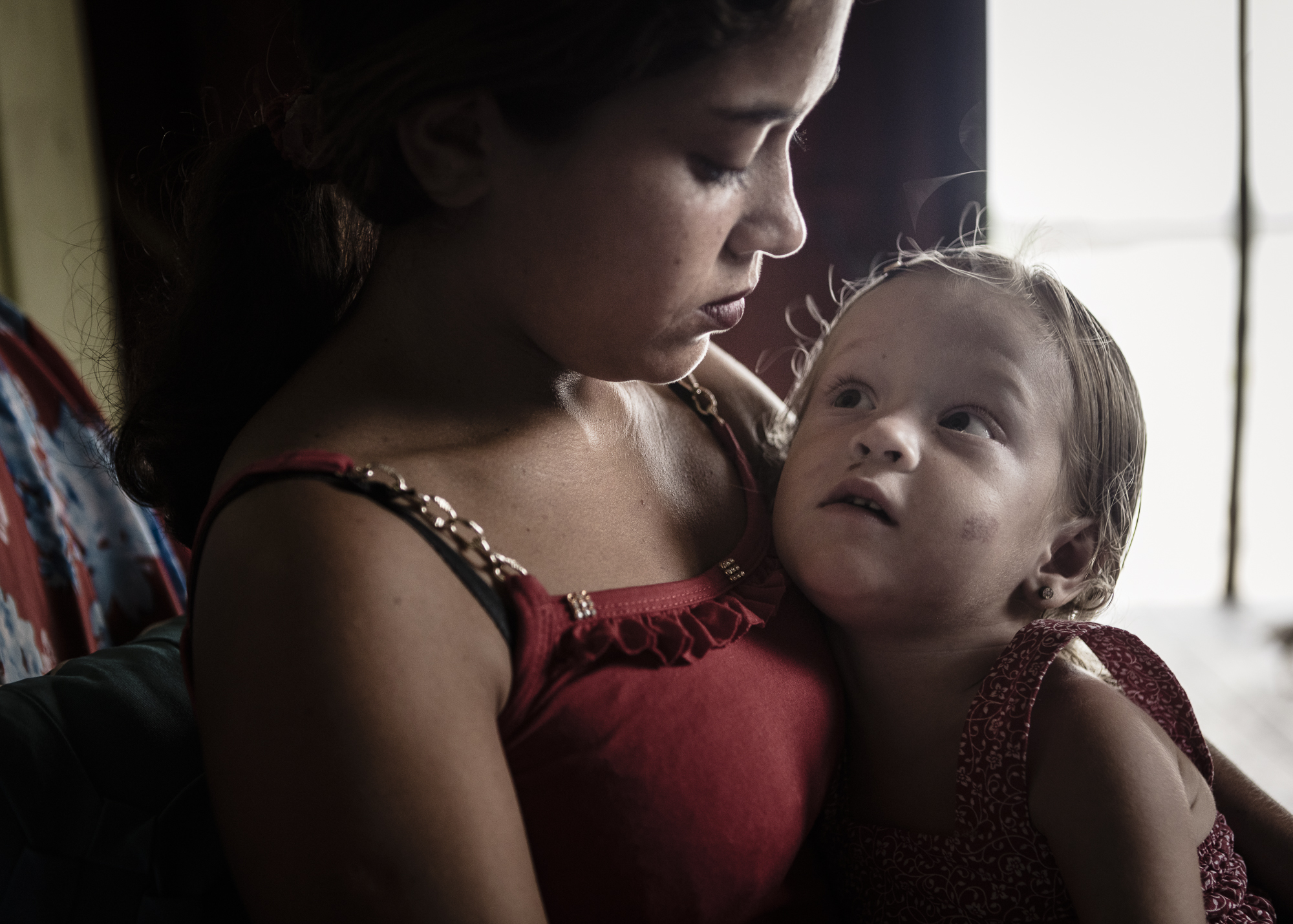 Portrait of Clara and her mother. The children is the youngest individual with albinism in the island.