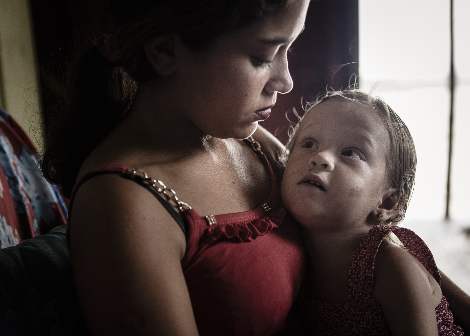 Portrait of Clara and her mother. The children is the youngest individual with albinism in the island.